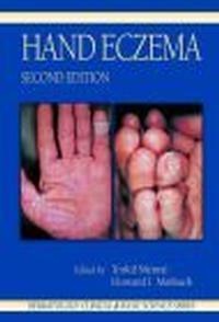 Okladka ksiazki hand eczema